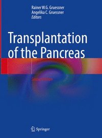 bokomslag Transplantation of the Pancreas