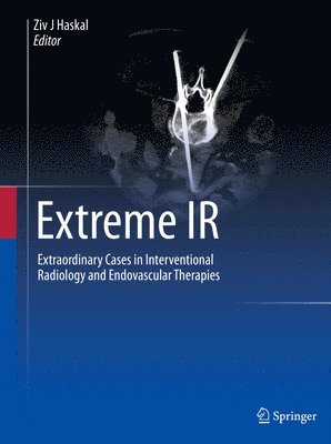 Extreme IR 1