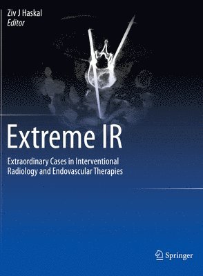 Extreme IR 1