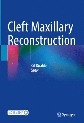 Cleft Maxillary Reconstruction 1