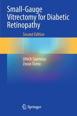 Small-Gauge Vitrectomy for Diabetic Retinopathy 1