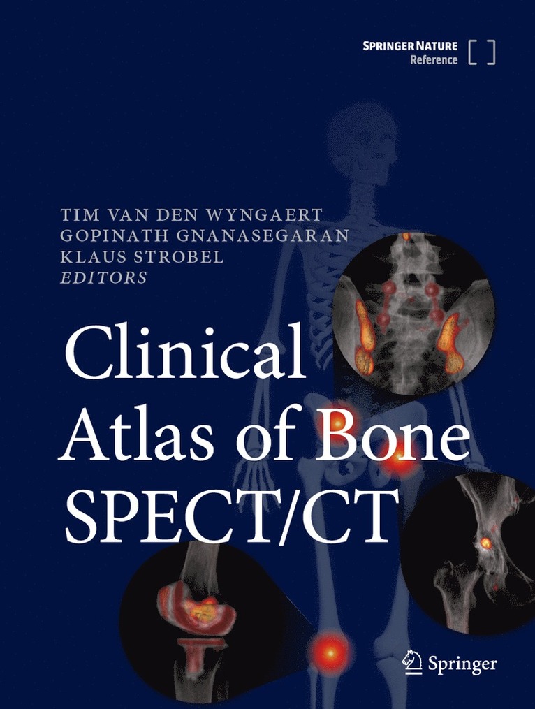Tim Van den Wyngaert, Gopinath Gnanasegaran, Klaus Strobel, Tim Van Den Wyngaert, Tim van den Wyngaert - Clinical Atlas of Bone SPECT/CT, Inbunden