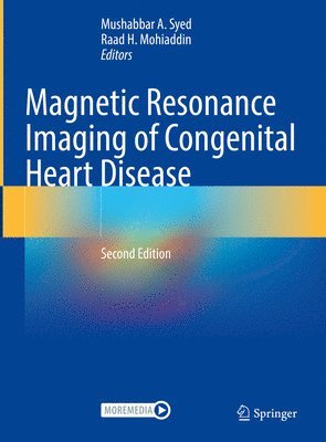 bokomslag Magnetic Resonance Imaging of Congenital Heart Disease