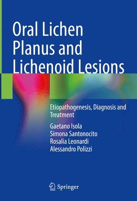 Oral Lichen Planus and Lichenoid Lesions 1
