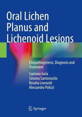 Oral Lichen Planus and Lichenoid Lesions 1