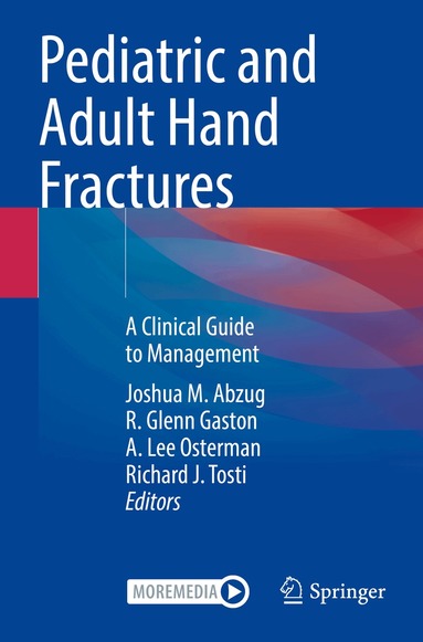 Joshua M. Abzug, R. Glenn Gaston, A. Lee Osterman, Richard J. Tosti - Pediatric and Adult Hand Fractures, Häftad