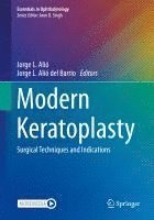 bokomslag Modern Keratoplasty