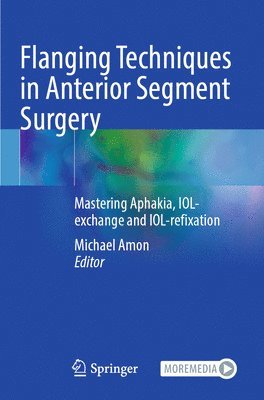 Flanging Techniques in Anterior Segment Surgery 1