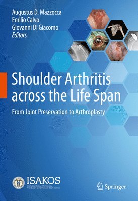 bokomslag Shoulder Arthritis across the Life Span