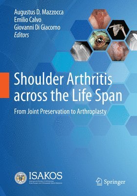 bokomslag Shoulder Arthritis across the Life Span