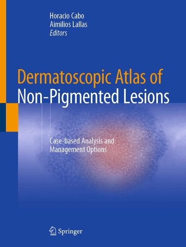 Horacio Cabo, Aimilios Lallas - Dermatoscopic Atlas of Non-Pigmented Lesions, Inbunden