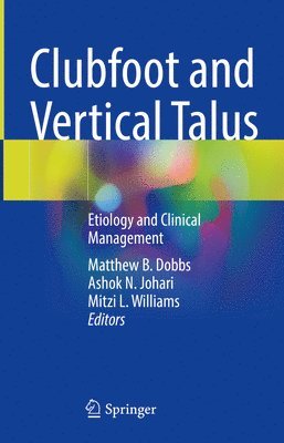 Clubfoot and Vertical Talus 1