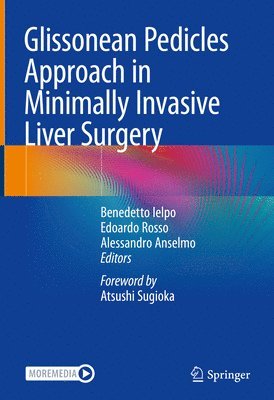 Glissonean Pedicles Approach in Minimally Invasive Liver Surgery 1