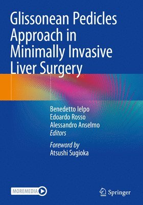 Glissonean Pedicles Approach in Minimally Invasive Liver Surgery 1