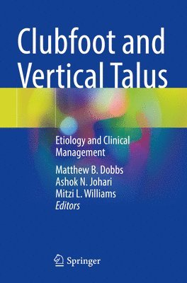 Clubfoot and Vertical Talus 1