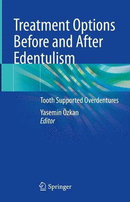 bokomslag Treatment Options Before and After Edentulism