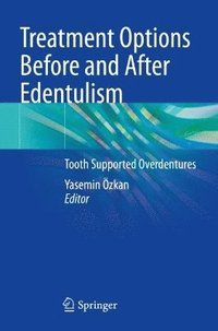 bokomslag Treatment Options Before and After Edentulism