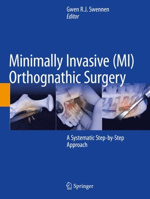 bokomslag Minimally Invasive (MI) Orthognathic Surgery