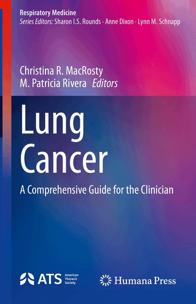 Christina R. MacRosty, M. Patricia Rivera - Lung Cancer, Inbunden