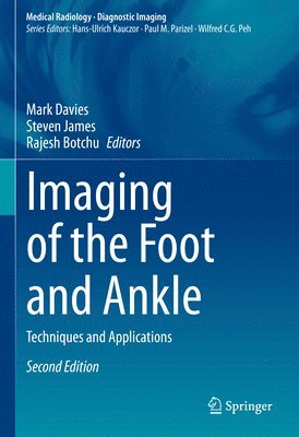 Imaging of the Foot and Ankle