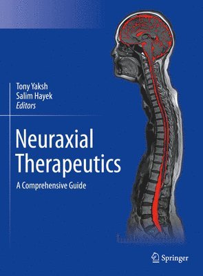 Neuraxial Therapeutics 1