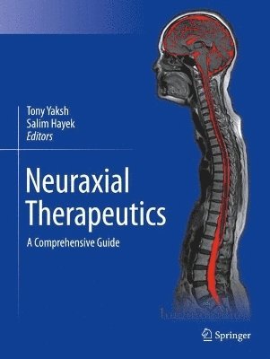 Neuraxial Therapeutics 1