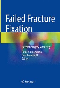 bokomslag Failed Fracture Fixation