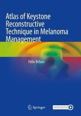 Atlas of Keystone Reconstructive Technique in Melanoma Management 1