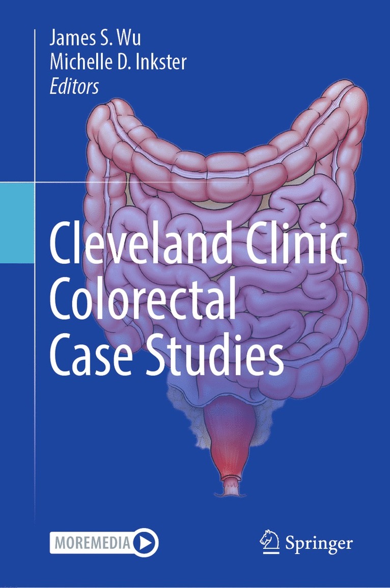 James S. Wu, Michelle D. Inkster - Cleveland Clinic Colorectal Case Studies, Inbunden