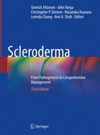 bokomslag Scleroderma