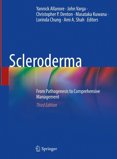 bokomslag Scleroderma