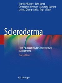 bokomslag Scleroderma