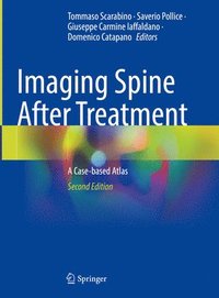 bokomslag Imaging Spine After Treatment
