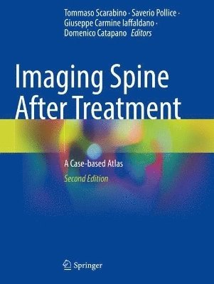 Imaging Spine After Treatment 1