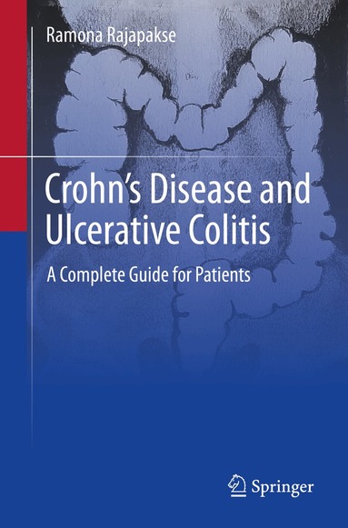 Ramona Rajapakse - Crohn's Disease and Ulcerative Colitis, Häftad