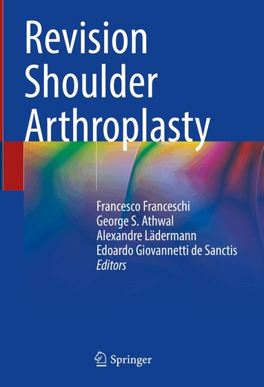 Francesco Franceschi, George S. Athwal, Alexandre Lädermann, Edoardo Giovannetti de Sanctis - Revision Shoulder Arthroplasty, Inbunden