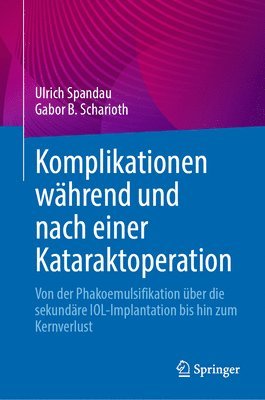 bokomslag Komplikationen whrend und nach einer Kataraktoperation