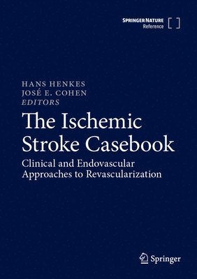 Hans Henkes, José E. Cohen, Jose E. Cohen - Ischemic Stroke Casebook, Inbunden