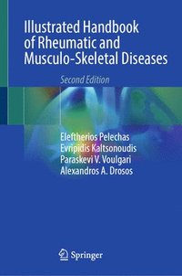 bokomslag Illustrated Handbook of Rheumatic and Musculo-Skeletal Diseases