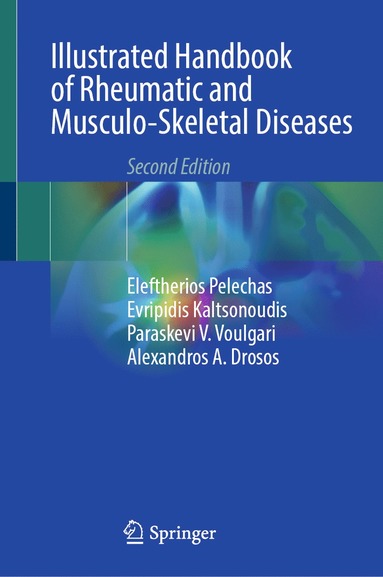 bokomslag Illustrated Handbook of Rheumatic and Musculo-Skeletal Diseases