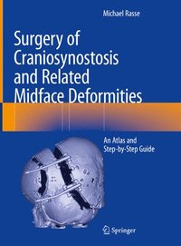 bokomslag Surgery of Craniosynostosis and Related Midface Deformities