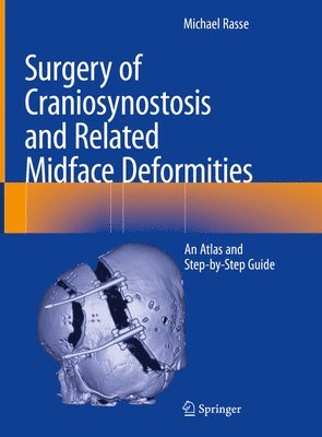 Surgery of Craniosynostosis and Related Midface Deformities 1