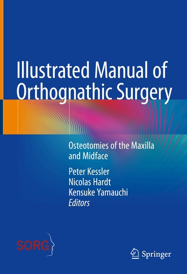 Peter Kessler, Nicolas Hardt, Kensuke Yamauchi - Illustrated Manual of Orthognathic Surgery, Inbunden