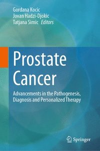 bokomslag Prostate Cancer