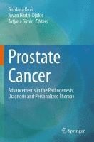 bokomslag Prostate Cancer
