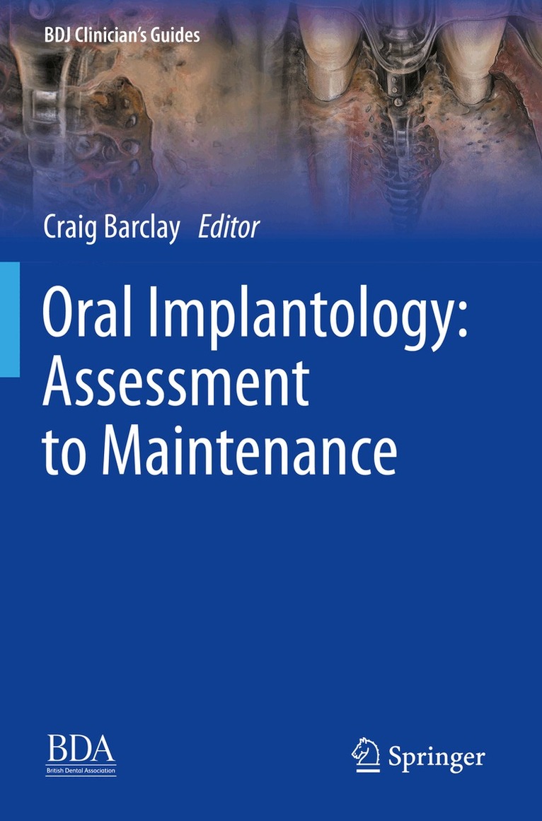 Craig Barclay - Oral Implantology: Assessment to Maintenance, Häftad
