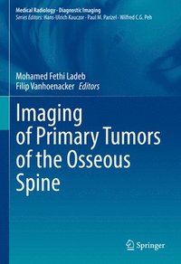 bokomslag Imaging of Primary Tumors of the Osseous Spine