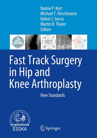 Nanne P. Kort, Michael T. Hirschmann, Rafael J. Sierra, Martin R. Thaler - Fast Track Surgery in Hip and Knee Arthroplasty, Inbunden