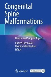 bokomslag Congenital Spine Malformations