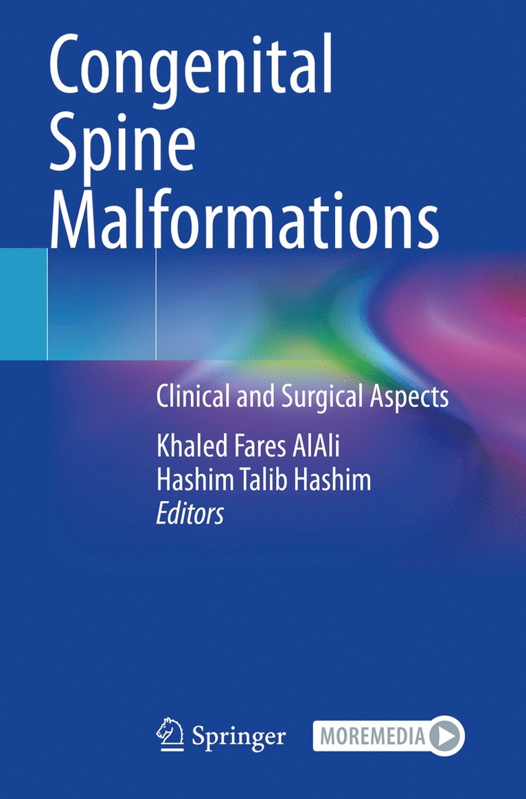 Khaled Fares AlAli, Hashim Talib Hashim, Khaled Fares Alali - Congenital Spine Malformations, Häftad